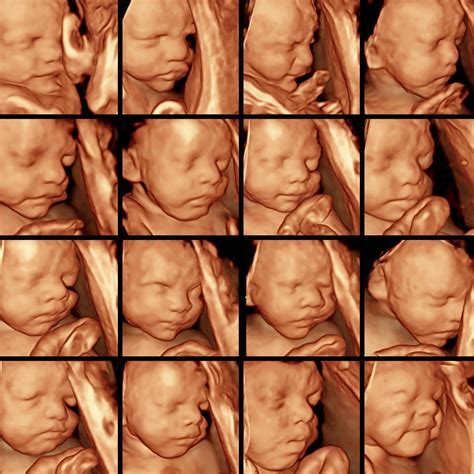 30 Weeks Scan Report