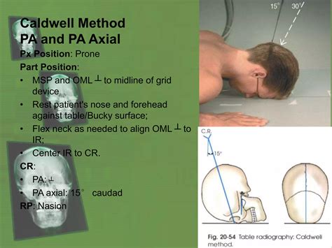 SKULL: Radiologic Positioning (Non-contrast) | PPTX