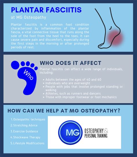 Plantar Fasciitis: Understanding and Treatment | Osteopathy