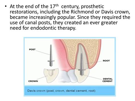 Introduction to Endodontics | PPTX
