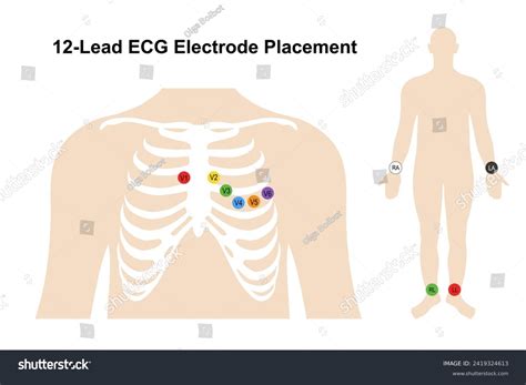 Electrocardiogram Lead Placement On The Body Ekg Lead Placement