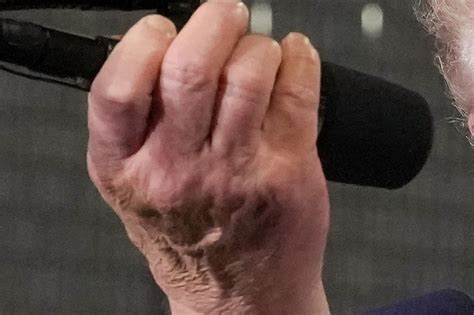 Trump’s Cankles on Full Display in Front of MAGA Boxing Star