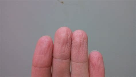 指尖发麻是啥征兆 10个指尖发麻是啥征兆 - 汽车时代网