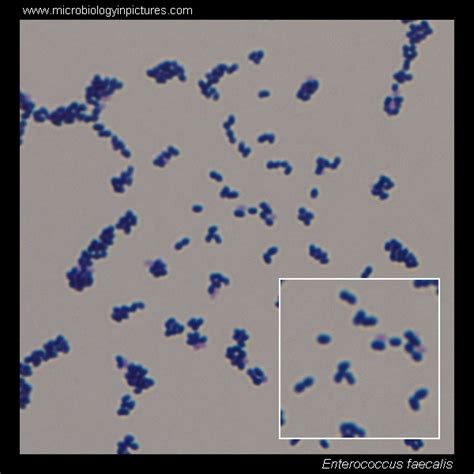 Dire riva disposto enterococcus faecalis gram stain Fare una ...