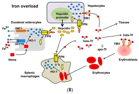 Iron Deficiency Anemia Ferritin at John Mccloud blog