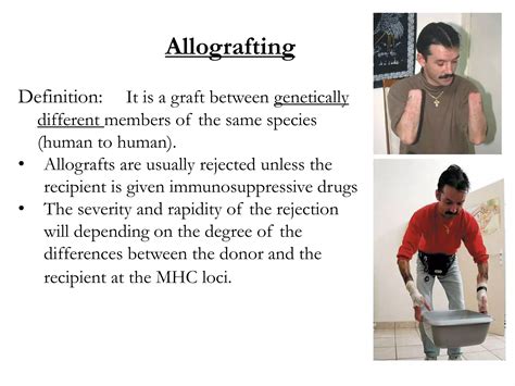 11_Transplantation_Immunity_types_of_grafts,_mechanisms_of_graft.ppt