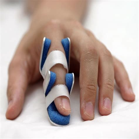 Finger Exercises For Sprained Finger at Heather Carlson blog