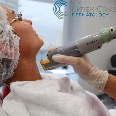 How is Facial Laser Epilation Performed | Is Facial Epilation Performed