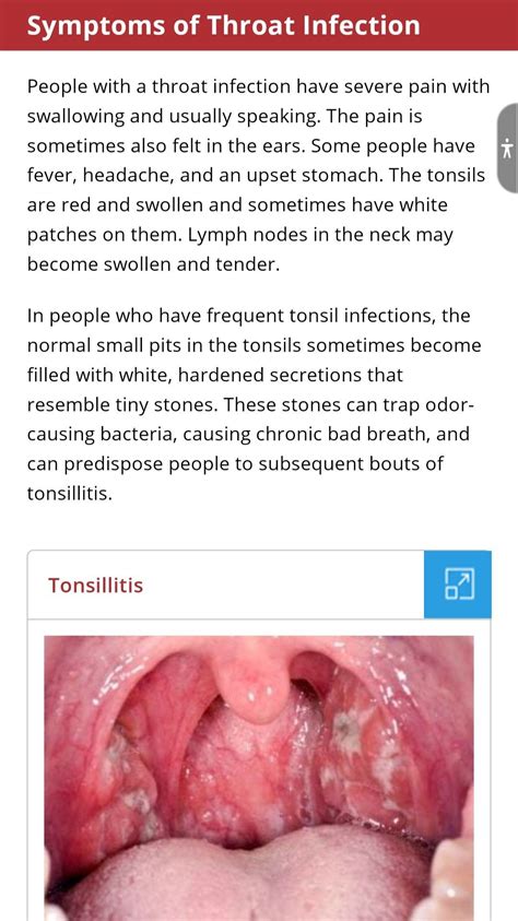 Normal Throat Pictures