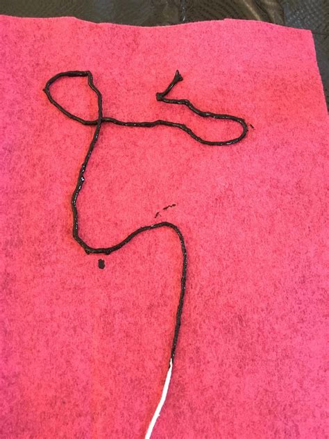 What Is A Fiber String In Stool at James Glassop blog