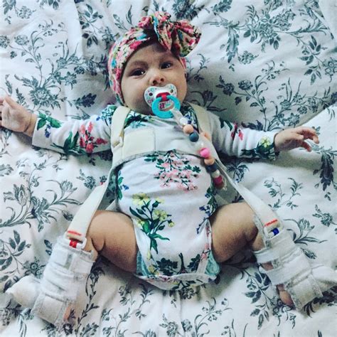Lily's E'Claires: Camille's Hip Dysplasia ~ Life with a Pavlik Harness
