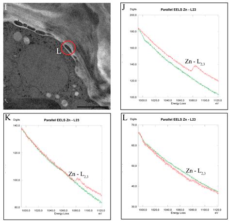 Subcellular Sequestration and Impact of Heavy Metals on the ...