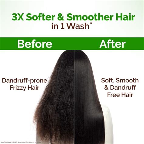 Mamaearth Lemon Anti Dandruff Conditioner 250 ml | Controls Frizz