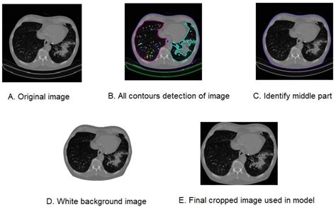 Detecting COVID-19 Effectively with Transformers and CNN-Based Deep ...