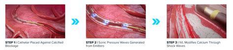 Image result for Python Pyplot Line Transparency Vector