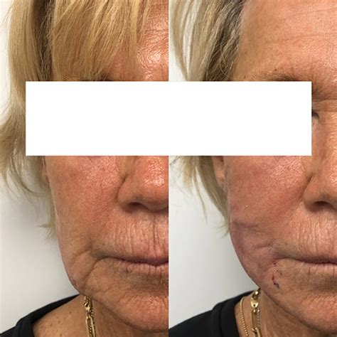 Image result for Face Threads