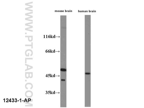 HOMER1 antibody (12433-1-AP) | Proteintech