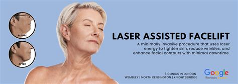 Laser Assisted Facelift – Rejuvenate & Tighten Your Skin Without Surgery