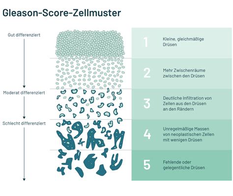 Gewebeuntersuchungen bei Prostatakrebs | leben-mit-prostatakrebs.de