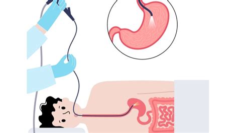 Dr Mahadevan B | Medical Gastroenterologist | Gleneagles Hospitals, Chennai