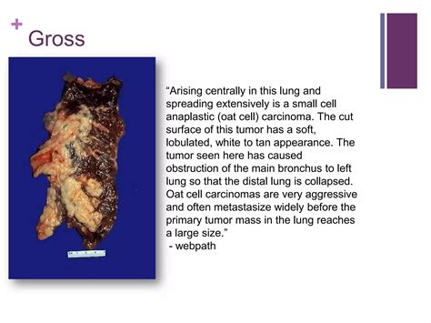 Lung Cancer Pathology & Clinical | PPTX
