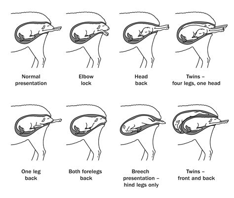 Birth In Different Presentation