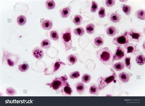 Stages Of Meiosis Microscope