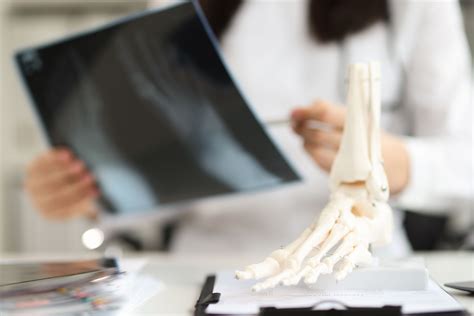 Sprained Ankle vs. Broken Ankle: How to Tell the Difference