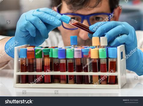 17,235 Tubes Hematology Images, Stock Photos & Vectors | Shutterstock