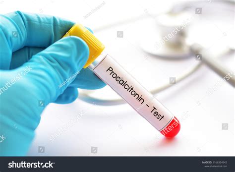PCT Sample Test 的图像结果