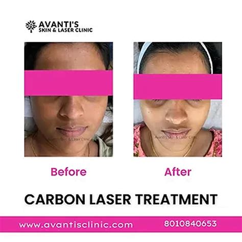 Skin Types 的图像结果