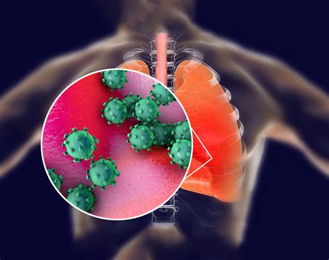 Pulmonologist in Thane – Dr. Gayatri Nair