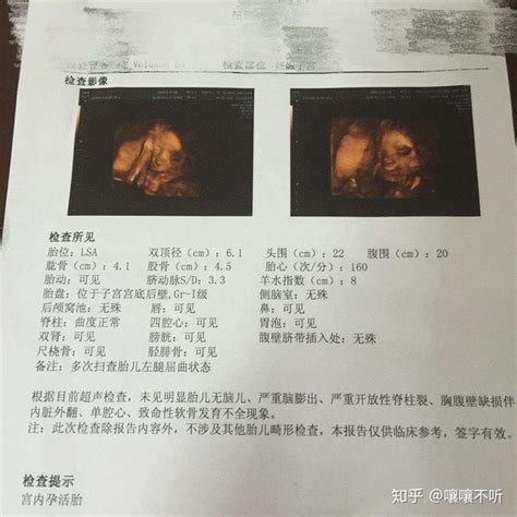 科学备孕男孩，已如愿儿女双全，分享好孕经验 - 知乎