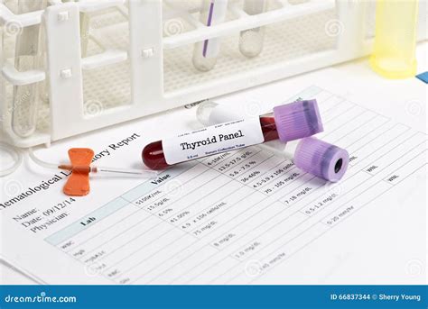 Thyroid Panel Lab Test stock photo. Image of hospital - 66837344