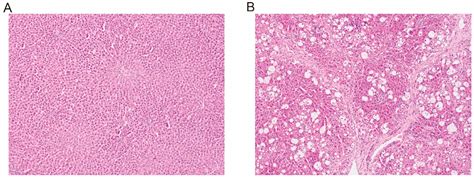 Effect of Hepatic Impairment on the Pharmacokinetics of Baicalin in ...