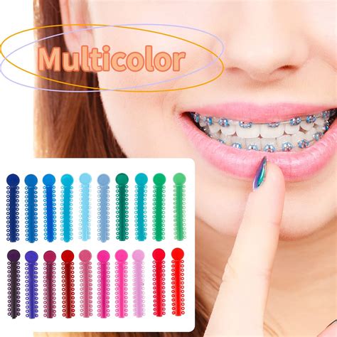 Braces Colors With Names at Charles Lindquist blog