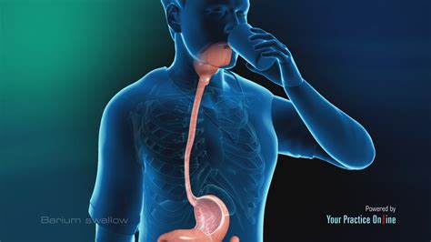 Upper Gastrointestinal Gi Tract Medical Exhibit