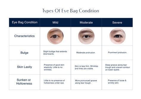 Kinds Of Eye Bags