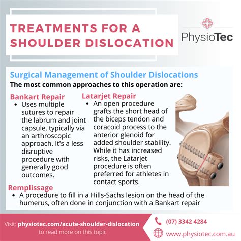 Acute Shoulder Dislocation | Diagnosis and Treatment