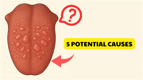 Multiple Bumps on the Back of Your Tongue? Most Likely Reasons