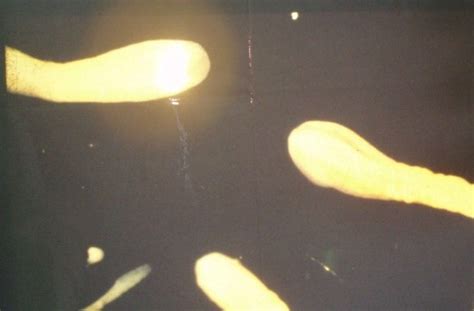 광절열두조충(Diphyllobothrium latum) Broad fish tapeworm : 네이버 블로그