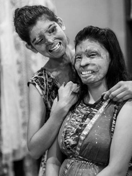 These Portraits of Acid Attack Survivors Will Help You See Their Lives ...
