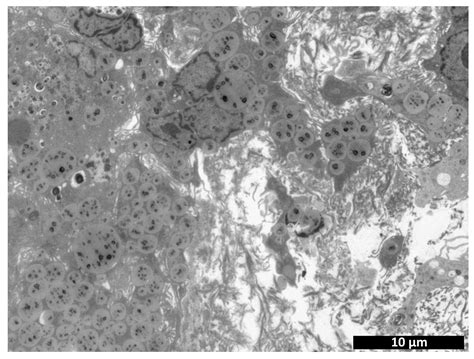 Biocompatibility Study of Hydrogel Biopolymer Scaffold with ...