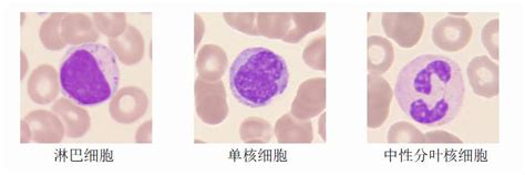 全自动血细胞形态学分析仪ME-150-杭州九洋生物科技有限公司