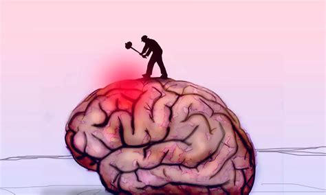 Migraine patients treated with anti-CGRP receptor antibodies at risk of ...