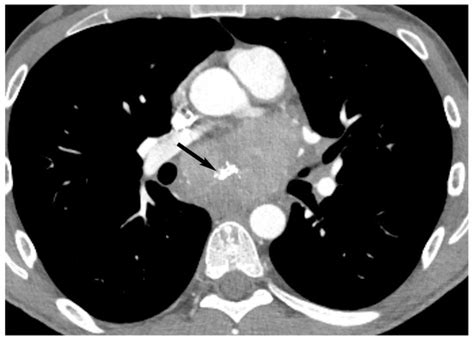 Diagnostics | Special Issue : Selected Topics in Thoracic Pathology