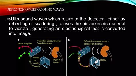 Understanding Ultrasound Physics