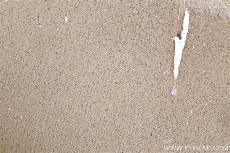 IHCeasy TH Ready-To-Use IHC Kit KHC2188 | Proteintech