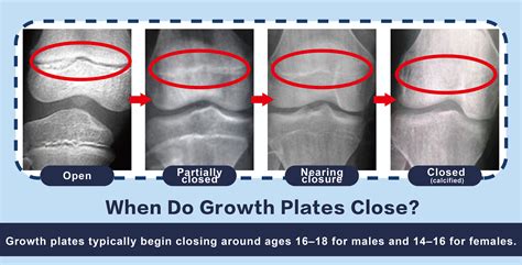 Image result for Appendix with Screen Shot Example