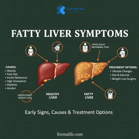Fatty Liver Symptoms - Live Nu Life